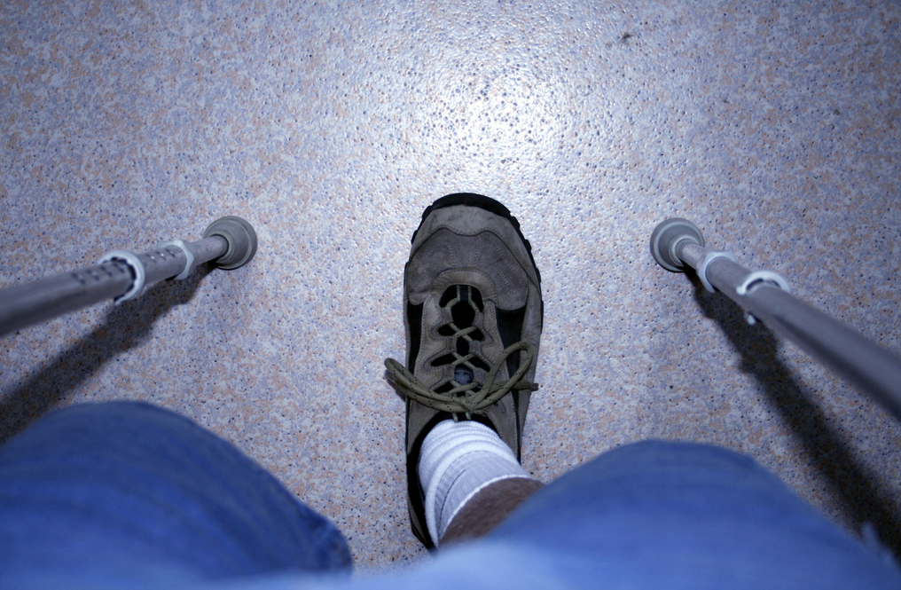 Worker’s Leg Injury Dubbed Body As A Whole for Benefit Purposes