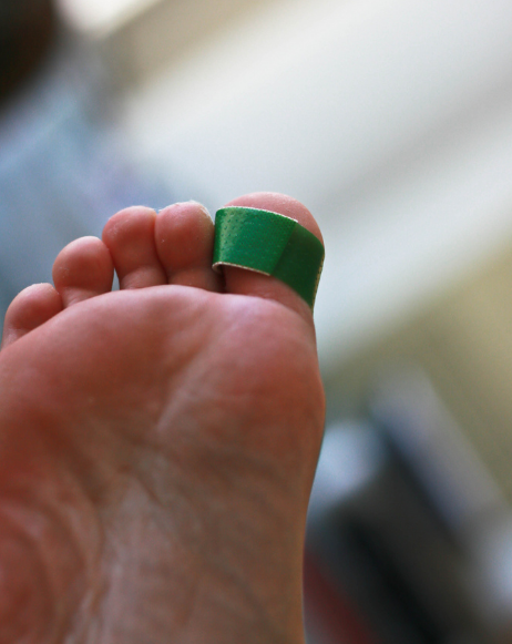 Injured Worker Pops Work-Related Blister, Not an Intervening Act in Infection Later On