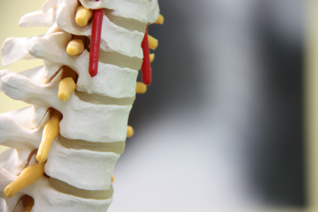 CA Court of Appeals Allows Apportionment to Genetics