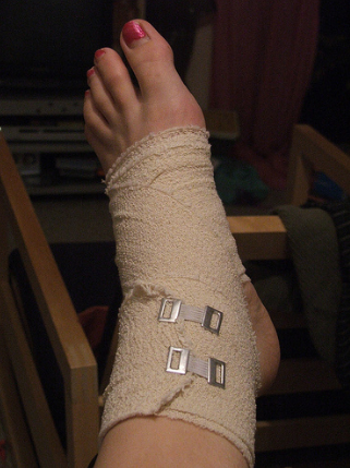 Are Wage-Loss Benefits Providing Adequately for Injured Workers