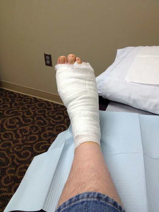 WA L&I Announces Center of Excellence for Burn Injuries