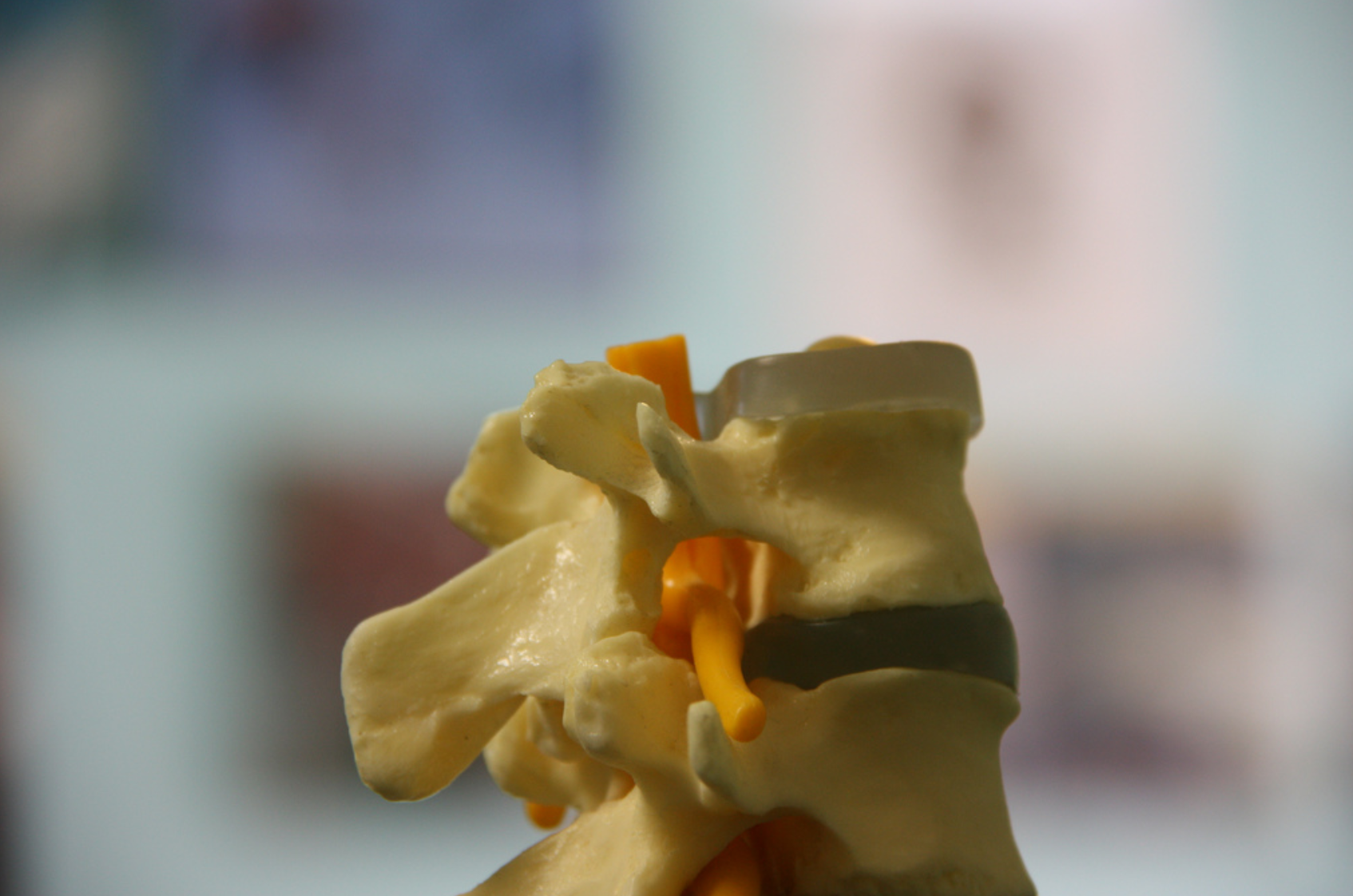 WY Worker’s Implant Deemed Alternative Medicine, Cannot Qualify for WC